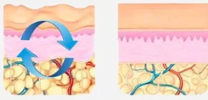 Illustration comparative du tissu cutané avant et après un massage profond qui améliore la circulation et l'aspect de la peau.