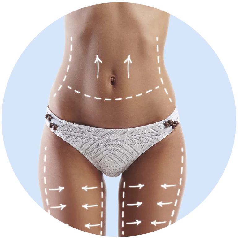 Abdominal area and thighs with marks and arrows indicating body remodeling through non-invasive aesthetic treatments.