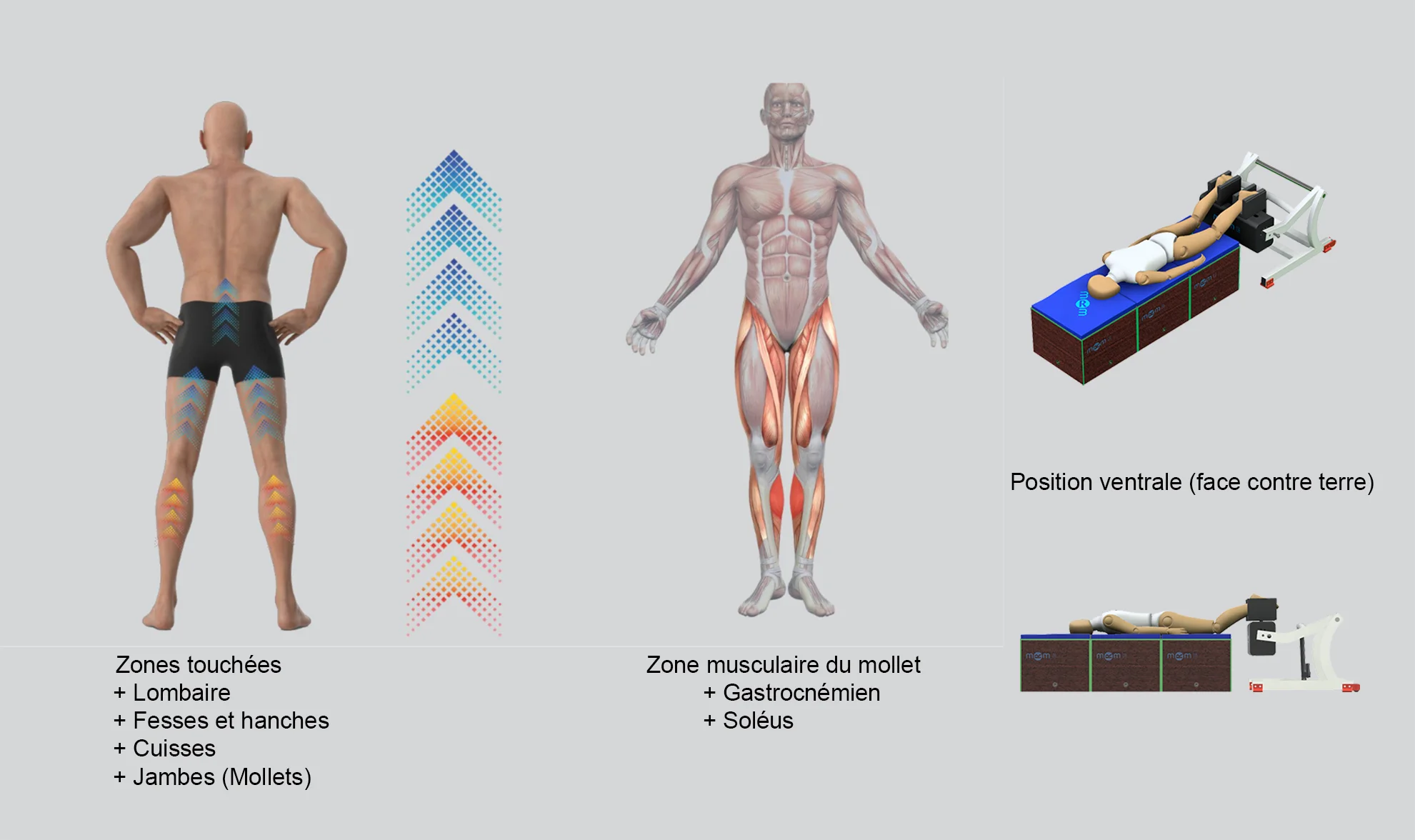 Traitement par appareil MRM en position couchée sur le ventre pour tonifier la chaîne postérieure. L'infographie illustre la stimulation du bas du dos, des fessiers, des hanches, des cuisses et des mollets (gastrocnémien et soléaire) pour remodeler la silhouette.