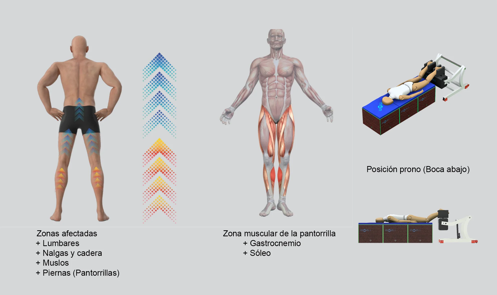 MRM Wellness: tonificación en decúbito prono para glúteos, piernas y zona lumbar Tratamiento con dispositivo MRM en posición boca abajo para tonificación de cadena posterior. La infografía muestra la estimulación de lumbares, glúteos, cadera, muslos y pantorrillas (gemelos y sóleo) para remodelación corporal.