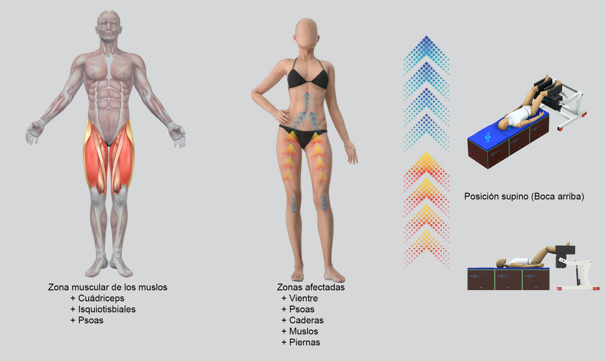 MRM Wellness: remodellación corporal en posición supina para piernas, glúteos y abdomen Tratamiento con el dispositivo MRM en posición boca arriba para la tonificación y remodelación de miembros inferiores. La infografía indica la estimulación profunda de cuádriceps, isquiotibiales, psoas, abdomen, caderas y piernas.
